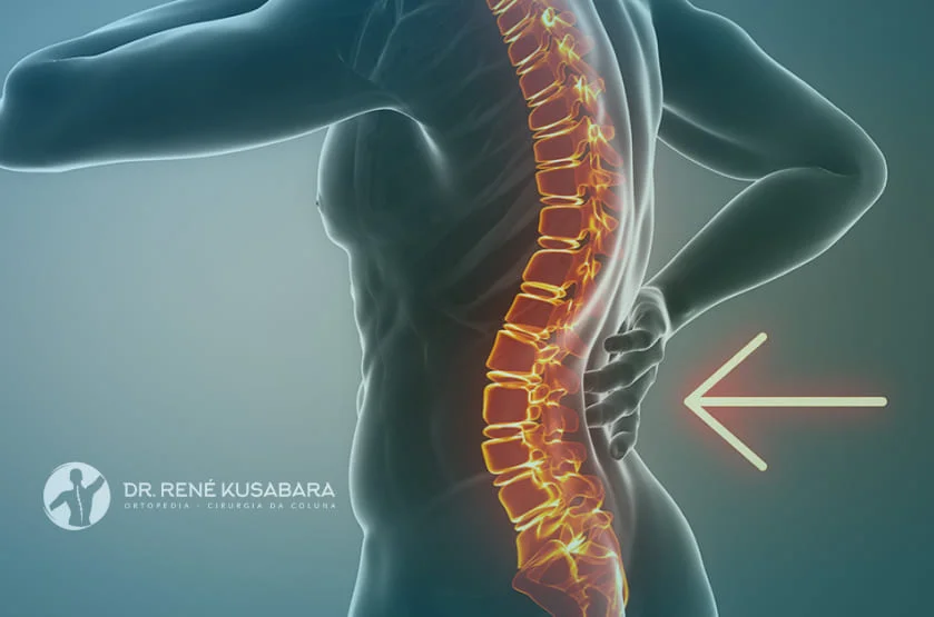 Acentuação da Lordose