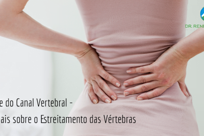 Estenose do Canal Vertebral - Saiba Mais sobre o Estreitamento das Vértebras Estenose do Canal Vertebral – Saiba Mais sobre o Estreitamento das Vértebras