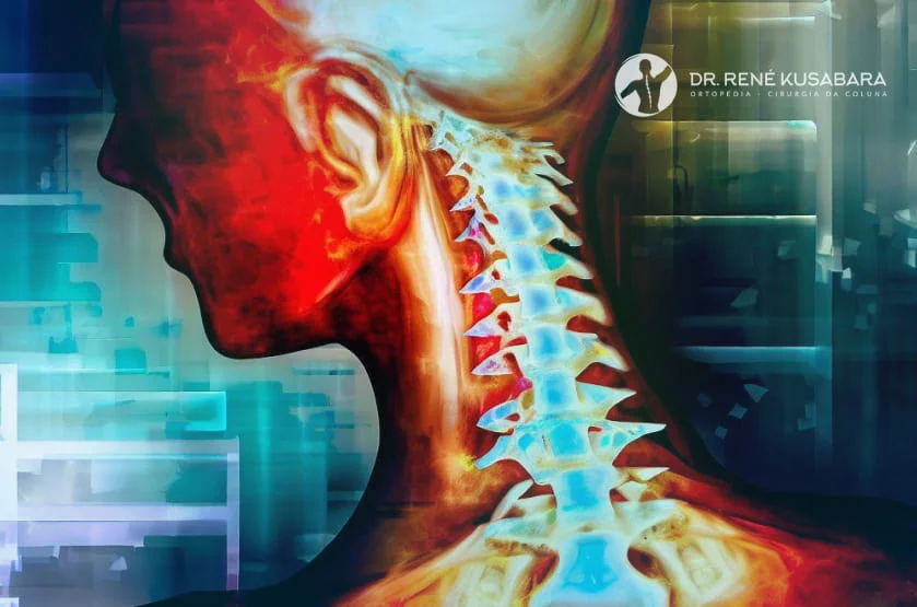 Doença Degenerativa da Coluna Cervical