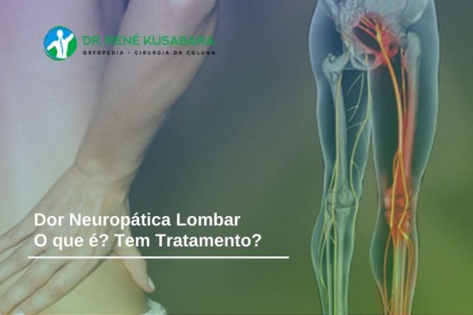 Dor Neuropática Lombar - O que é? Tem Tratamento? Dor Neuropática Lombar – O que é? Tem Tratamento?