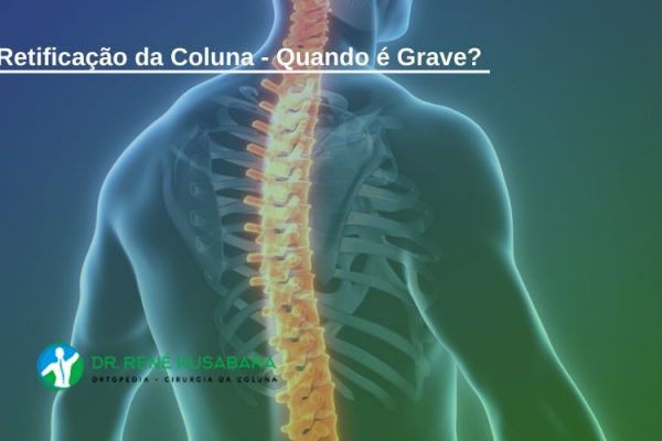 Retificação da Coluna - Quando é Grave? Retificação da Coluna – Quando é Grave?