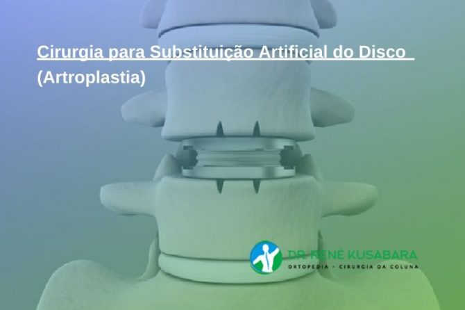 Cirurgia para Substituição Artificial do Disco (Artroplastia)