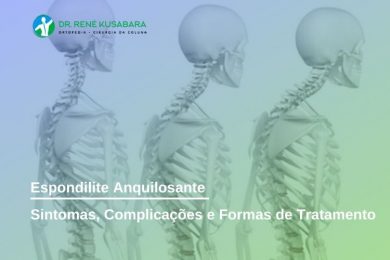 Espondilite Anquilosante Sintomas Complicações e Tratamento