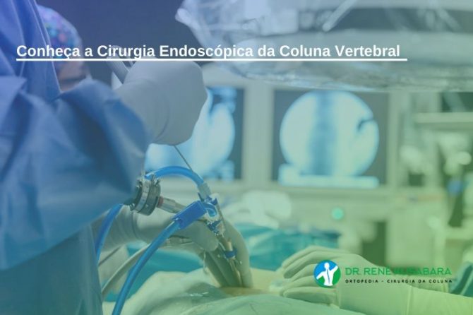 Conheça a Cirurgia Endoscópica da Coluna Vertebral