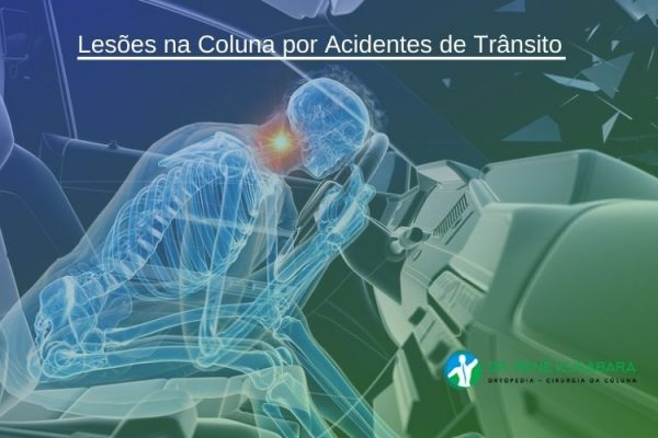 Lesões na Coluna por Acidentes de Trânsito