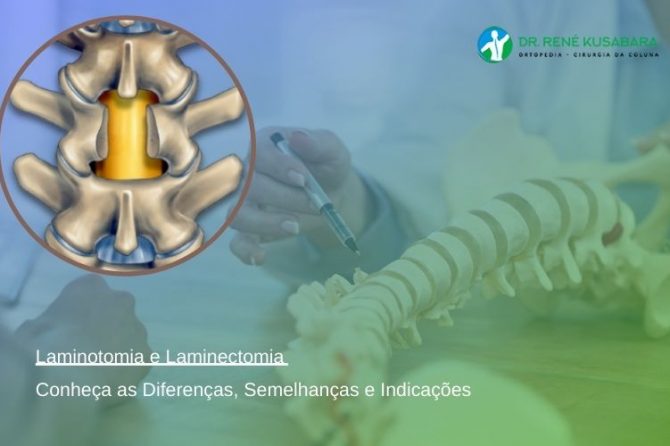 Laminotomia e Laminectomia – Diferenças, Semelhanças e Indicações