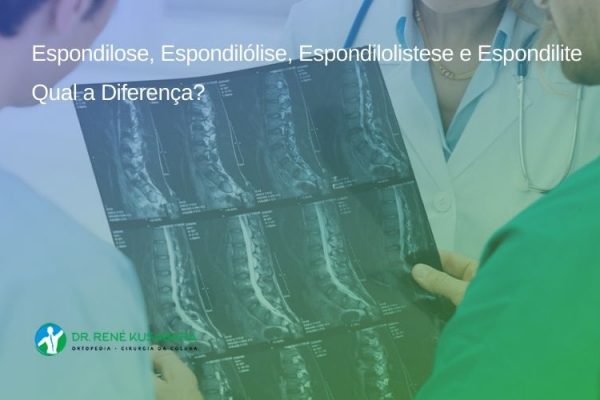 Espondilose, Espondilólise, Espondilolistese e Espondilite – Qual a Diferença?