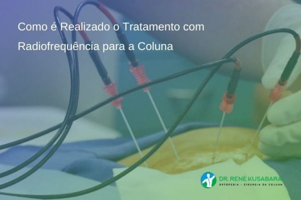 Como é Realizado o Tratamento com Radiofrequência para a Coluna