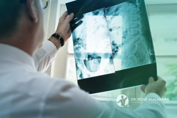 Infecções da Coluna Vertebral – Quando é Grave? Quando a Cirurgia é Indicada?