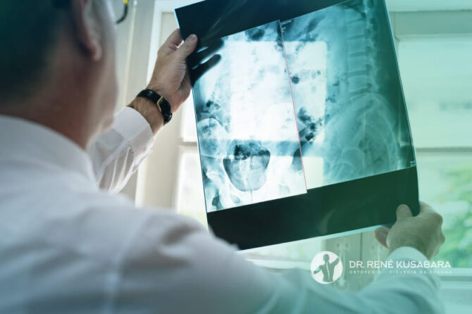 Infecções da Coluna Vertebral