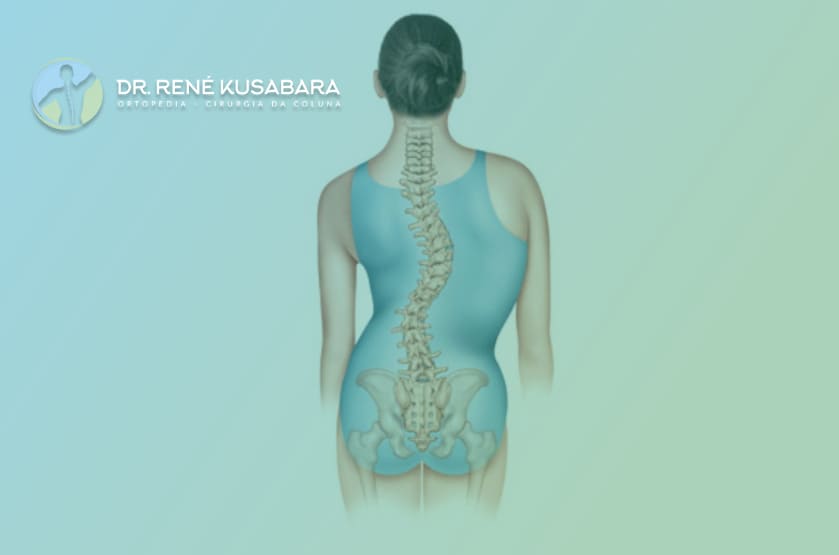 Conheça as principais causas da escoliose » Centro Ortopédico
