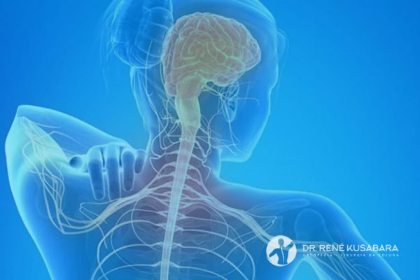 Nervo Comprimido no Pescoço – Causas, Sintomas e Tratamento