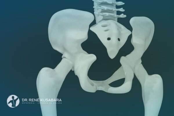 Dor no Cóccix: Quando Procurar um Médico para Aliviar o Desconforto